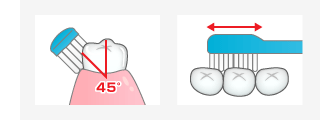 45度にブラシを当て、毛先を歯と歯ぐきの間に入れ、軽い力で小刻みに動かす図