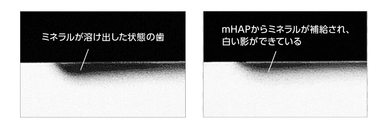 歯の再石灰化データ